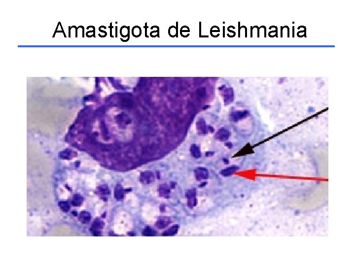 Amastigota de Leishmania 