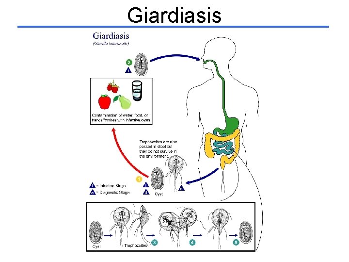 Giardiasis 