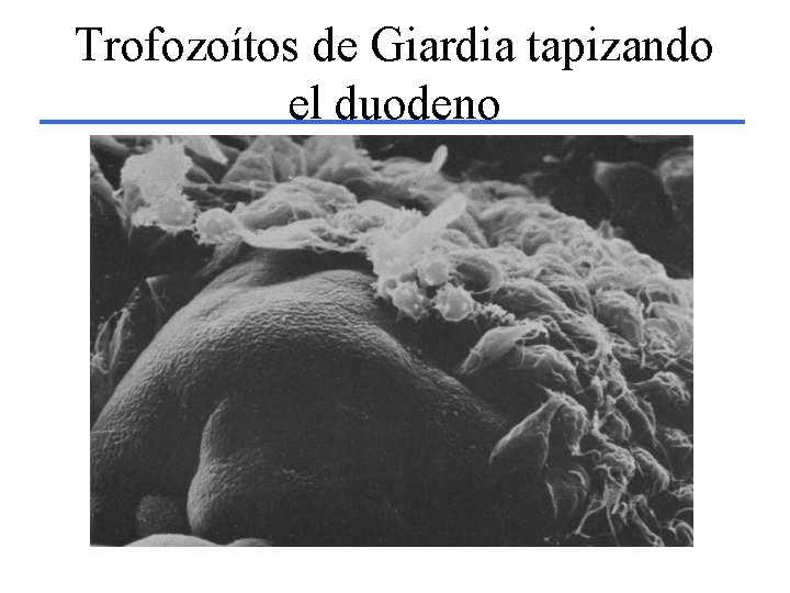 Trofozoítos de Giardia tapizando el duodeno 