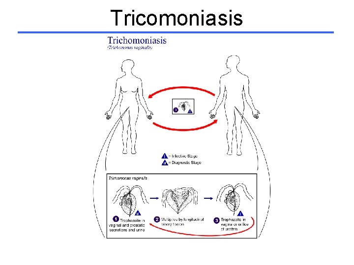 Tricomoniasis 