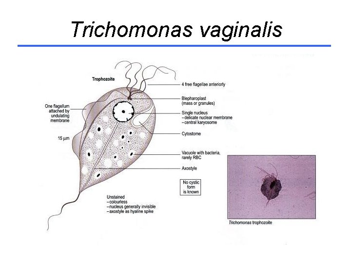 Trichomonas vaginalis 