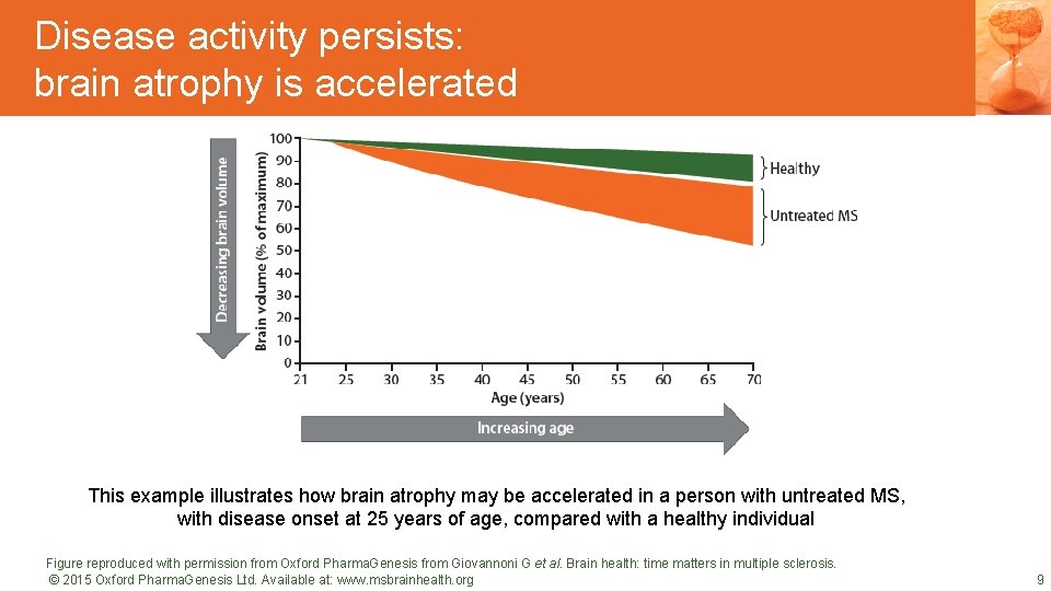 Disease activity persists: brain atrophy is accelerated DRAFT SLIDES This example illustrates how brain