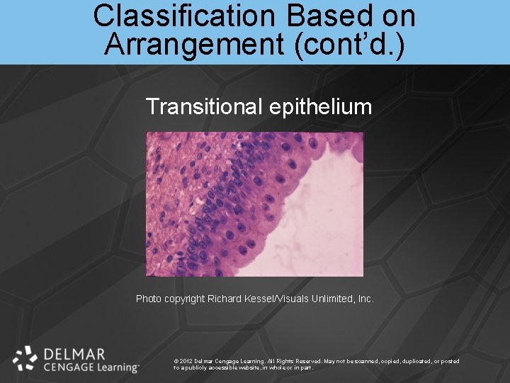 Classification Based on Arrangement (cont’d. ) Transitional epithelium Photo copyright Richard Kessel/Visuals Unlimited, Inc.