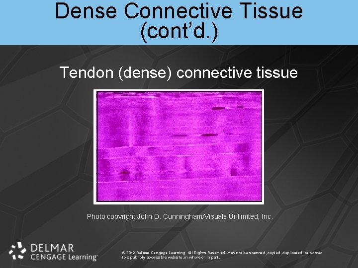 Dense Connective Tissue (cont’d. ) Tendon (dense) connective tissue Photo copyright John D. Cunningham/Visuals