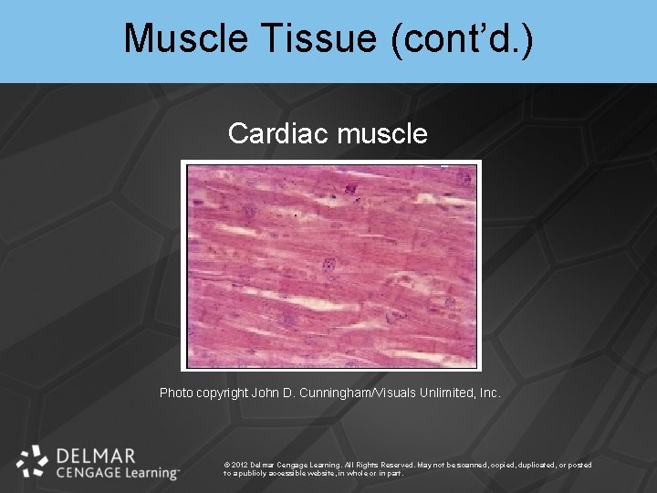 Muscle Tissue (cont’d. ) Cardiac muscle Photo copyright John D. Cunningham/Visuals Unlimited, Inc. ©