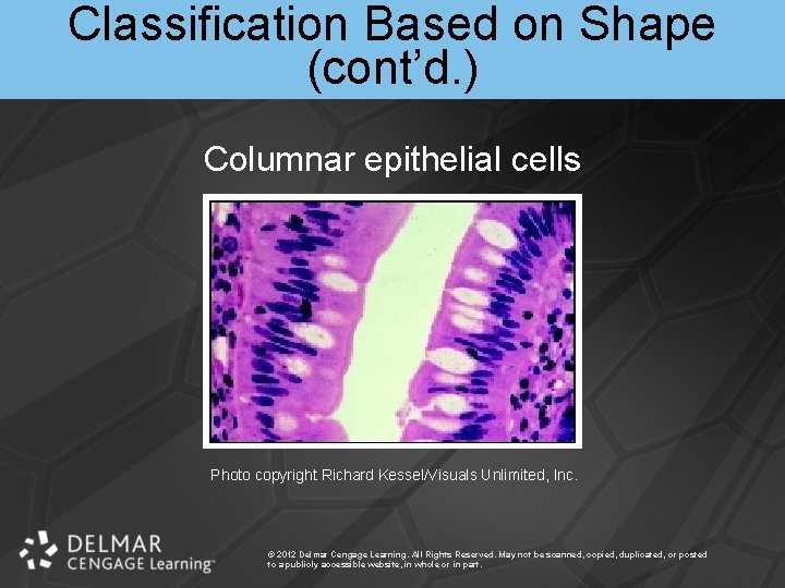 Classification Based on Shape (cont’d. ) Columnar epithelial cells Photo copyright Richard Kessel/Visuals Unlimited,