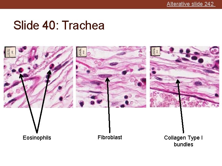 Alterative slide 242 Slide 40: Trachea Eosinophils Fibroblast Collagen Type I bundles 
