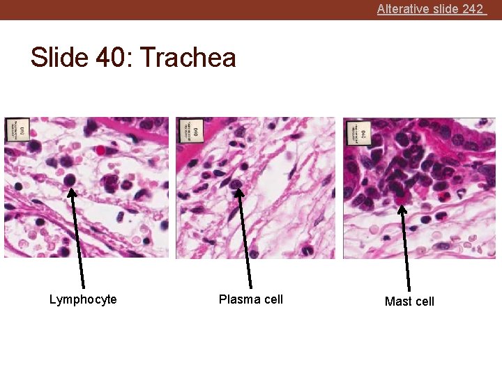 Alterative slide 242 Slide 40: Trachea Lymphocyte Plasma cell Mast cell 