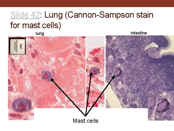 Slide 42: Lung (Cannon-Sampson stain for mast cells) intestine lung Mast cells 