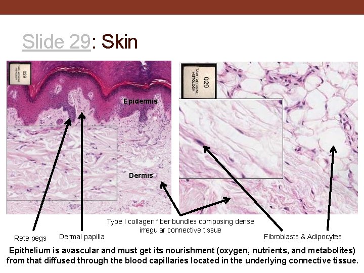 Slide 29: Skin Epidermis Dermis Rete pegs Dermal papilla Type I collagen fiber bundles