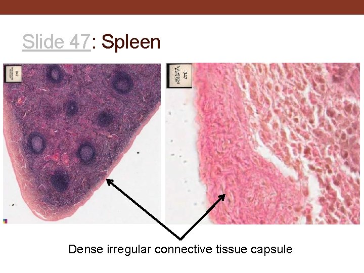 Slide 47: Spleen Dense irregular connective tissue capsule 