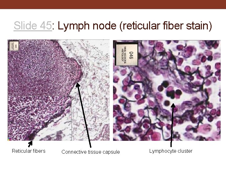 Slide 45: Lymph node (reticular fiber stain) Reticular fibers Connective tissue capsule Lymphocyte cluster