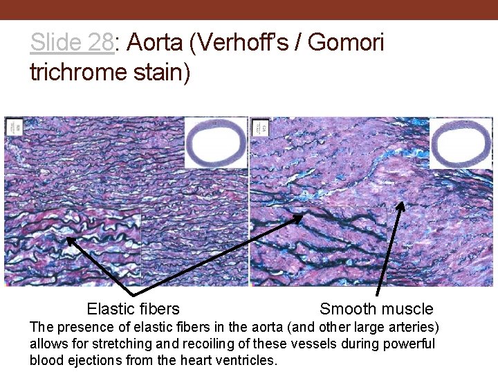 Slide 28: Aorta (Verhoff’s / Gomori trichrome stain) Elastic fibers Smooth muscle The presence