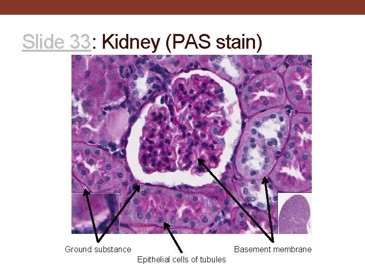 Slide 33: Kidney (PAS stain) Ground substance Basement membrane Epithelial cells of tubules 