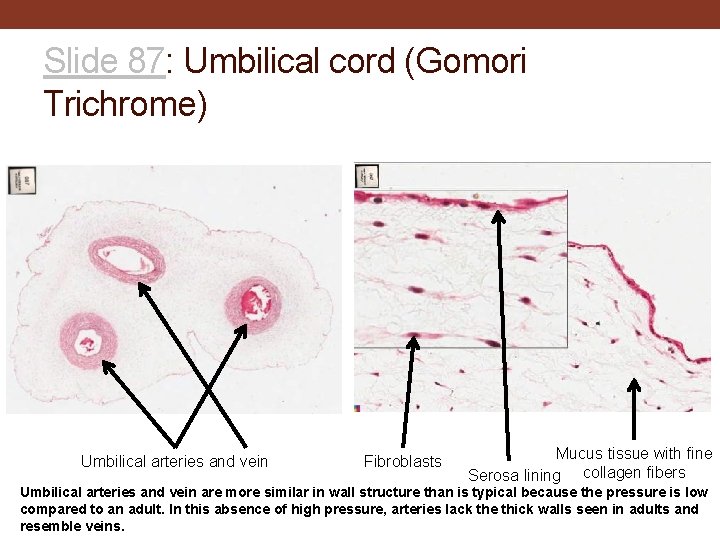 Slide 87: Umbilical cord (Gomori Trichrome) Umbilical arteries and vein Fibroblasts Mucus tissue with