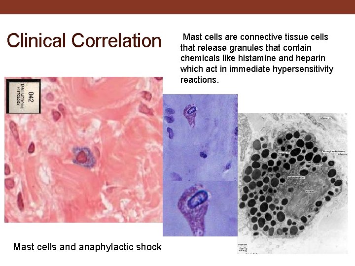 Clinical Correlation Mast cells and anaphylactic shock Mast cells are connective tissue cells that