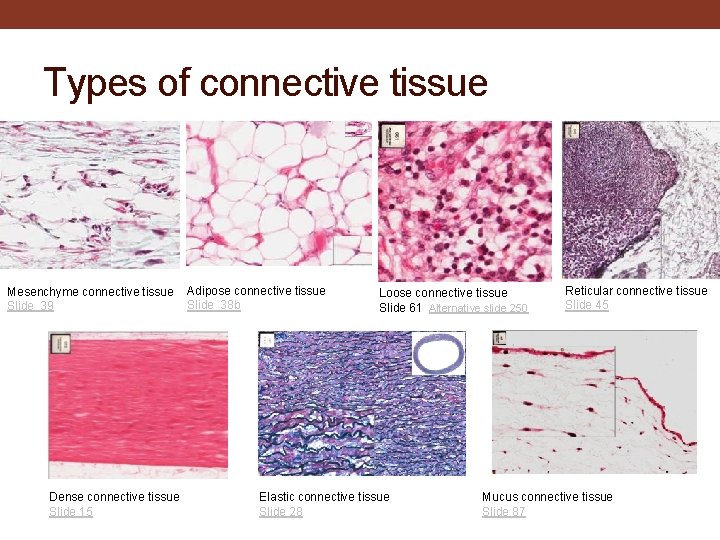 Types of connective tissue Mesenchyme connective tissue Slide 39 Dense connective tissue Slide 15