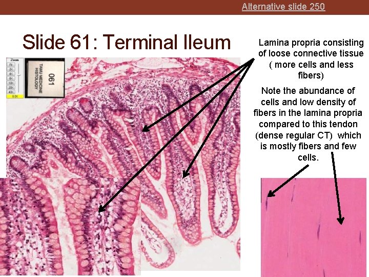 Alternative slide 250 Slide 61: Terminal Ileum Lamina propria consisting of loose connective tissue