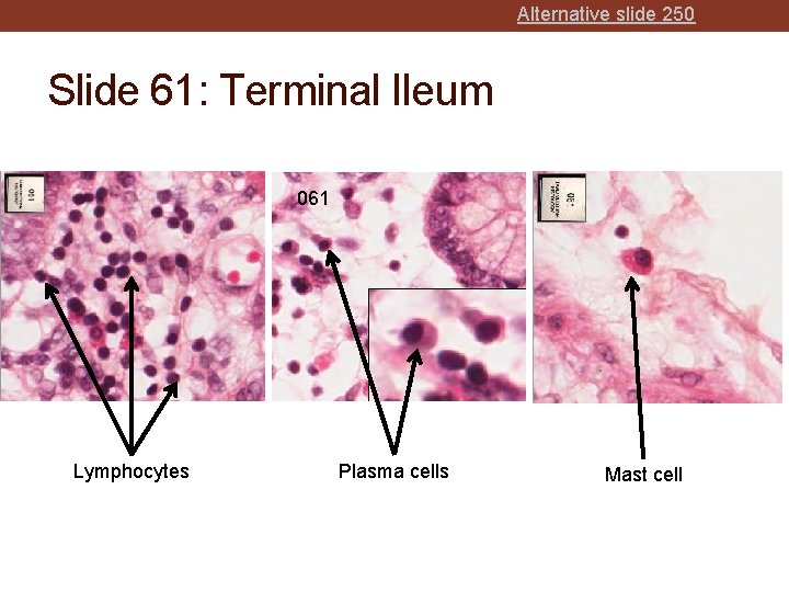 Alternative slide 250 Slide 61: Terminal Ileum 061 Lymphocytes Plasma cells Mast cell 