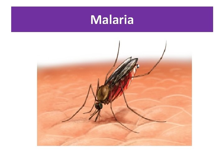 Malaria 