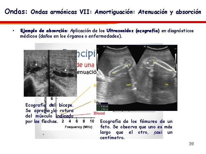 Ondas: Ondas armónicas VII: Amortiguación: Atenuación y absorción • Ejemplo de absorción: Aplicación de