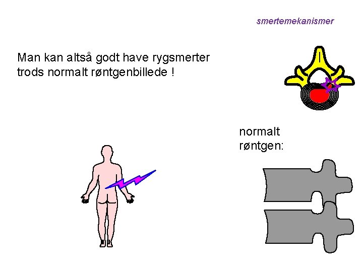 smertemekanismer Man kan altså godt have rygsmerter trods normalt røntgenbillede ! normalt røntgen: 