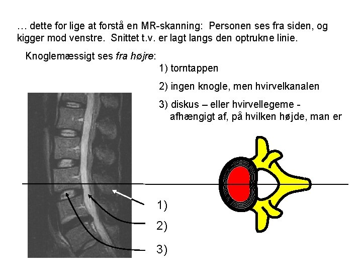 … dette for lige at forstå en MR-skanning: Personen ses fra siden, og kigger