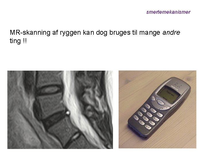 smertemekanismer MR-skanning ryggen kan dogbillede brugesaftildiscus mange andre Det vil sige, viaf kan tage