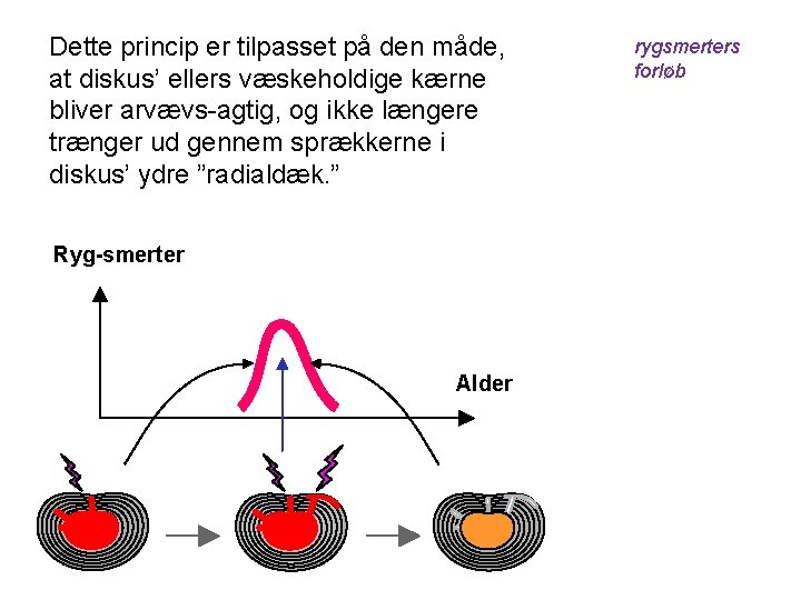 Dette princip er tilpasset på den måde, at diskus’ ellers væskeholdige kærne bliver arvævs-agtig,