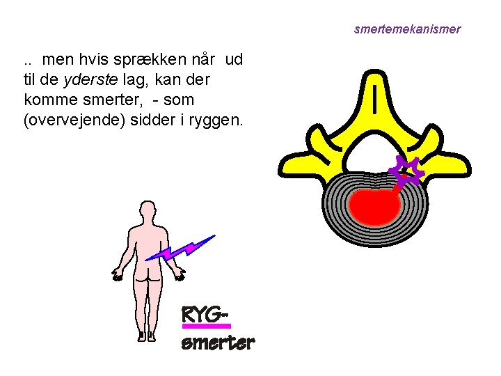 smertemekanismer . . men hvis sprækken når ud til de yderste lag, kan der