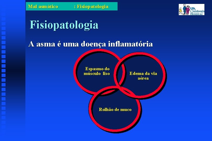 Mal asmático : Fisiopatologia A asma é uma doença inflamatória Espasmo do músculo liso