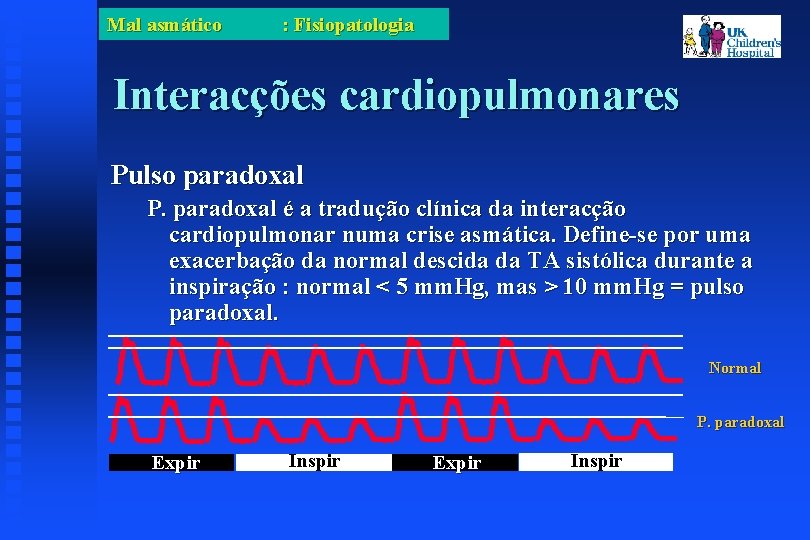 Mal asmático : Fisiopatologia Interacções cardiopulmonares Pulso paradoxal P. paradoxal é a tradução clínica