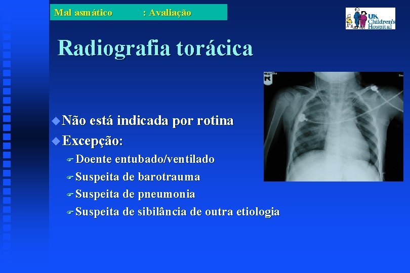 Mal asmático : Avaliação Radiografia torácica Não está indicada por rotina Excepção: Doente entubado/ventilado