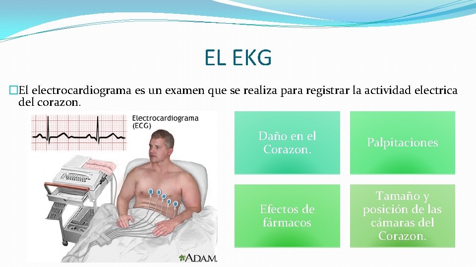 EL EKG �El electrocardiograma es un examen que se realiza para registrar la actividad