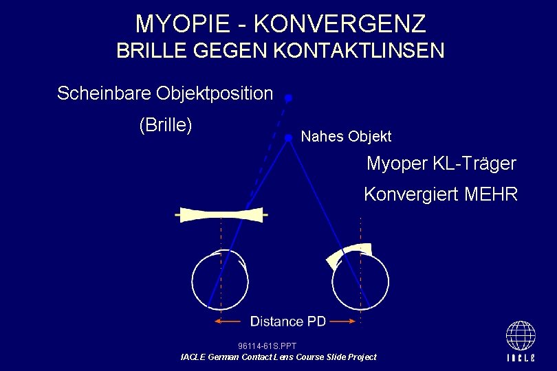MYOPIE - KONVERGENZ BRILLE GEGEN KONTAKTLINSEN Scheinbare Objektposition (Brille) Nahes Objekt Myoper KL-Träger Konvergiert