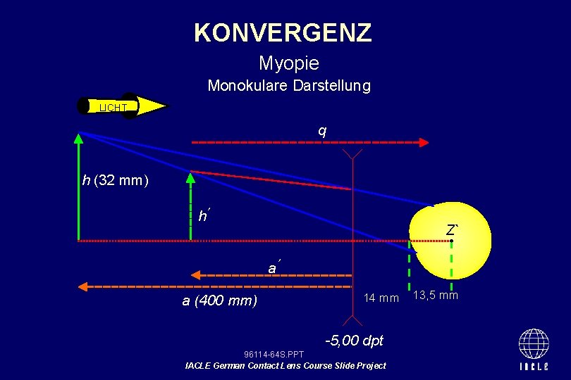 KONVERGENZ Myopie Monokulare Darstellung LICHT q h (32 mm) h Z` a a (400