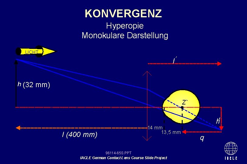 KONVERGENZ Hyperopie Monokulare Darstellung LICHT I h (32 mm) Z` I (400 mm) 14