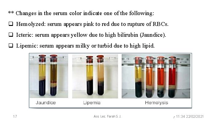 ** Changes in the serum color indicate one of the following: q Hemolyzed: serum
