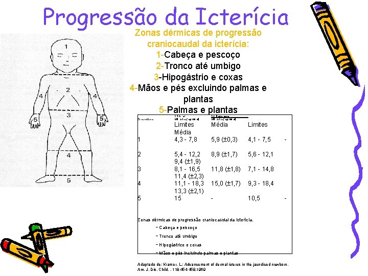 Progressão da Icterícia Zonas dérmicas de progressão craniocaudal da icterícia: 1 -Cabeça e pescoço