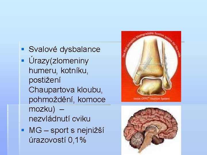 § Svalové dysbalance § Úrazy(zlomeniny humeru, kotníku, postižení Chaupartova kloubu, pohmoždění, komoce mozku) –