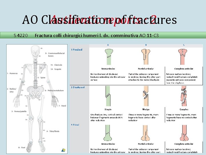 AO Classification of fractures Authentic reports : 2 S 4220 Fractura colli chirurgici humeri