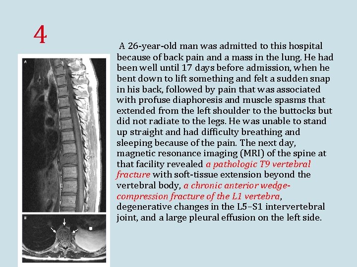 4 A 26 -year-old man was admitted to this hospital because of back pain 4 A 26 -year-old man was admitted to this hospital because of back pain