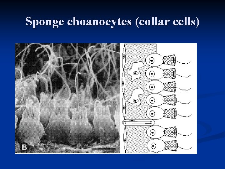 Sponge choanocytes (collar cells) 