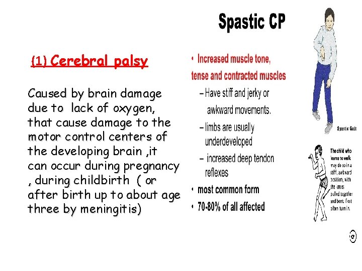 (1) Cerebral palsy Caused by brain damage due to lack of oxygen, that cause