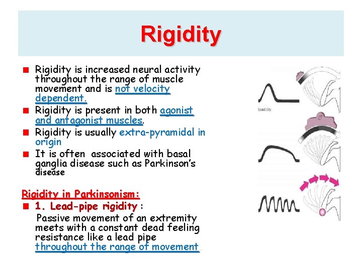 Rigidity is increased neural activity throughout the range of muscle movement and is not