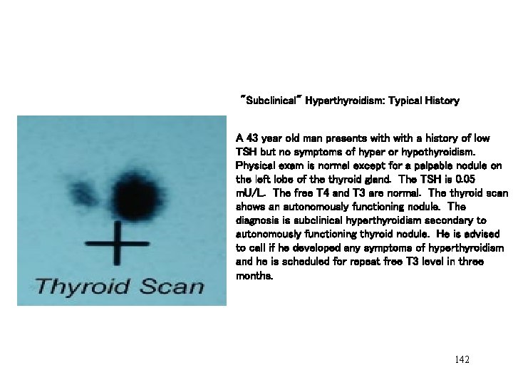 "Subclinical" Hyperthyroidism: Typical History A 43 year old man presents with a history of