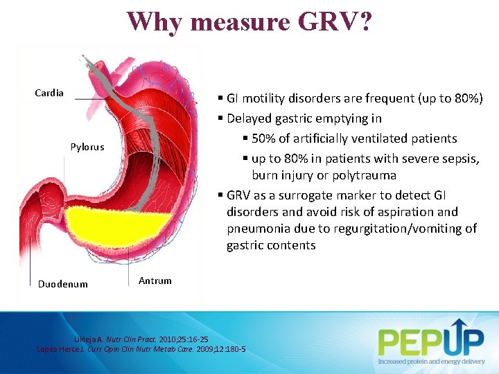 Why measure GRV? Cardia § GI motility disorders are frequent (up to 80%) §