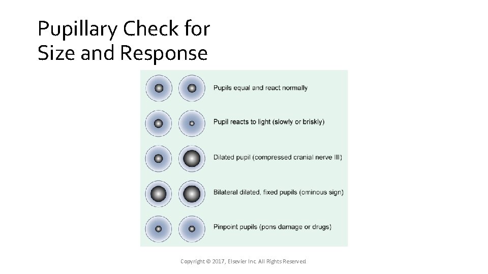 Pupillary Check for Size and Response Copyright © 2017, Elsevier Inc. All Rights Reserved. Pupillary Check for Size and Response Copyright © 2017, Elsevier Inc. All Rights Reserved.