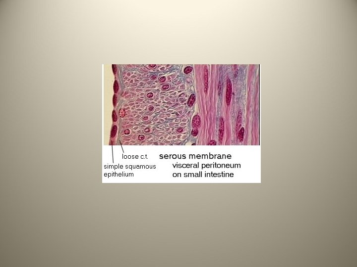 malignant mesothelioma abdomen