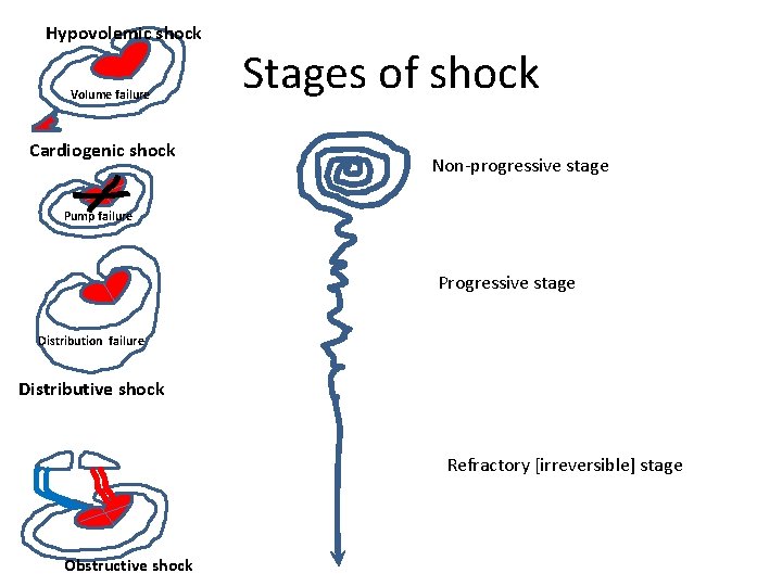 Hypovolemic shock Volume failure Cardiogenic shock Stages of shock Non-progressive stage Pump failure Progressive Hypovolemic shock Volume failure Cardiogenic shock Stages of shock Non-progressive stage Pump failure Progressive